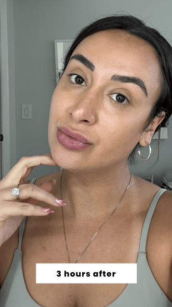 Trakoshis 3 hours after applying Benetint's Cheek  Lip Stain