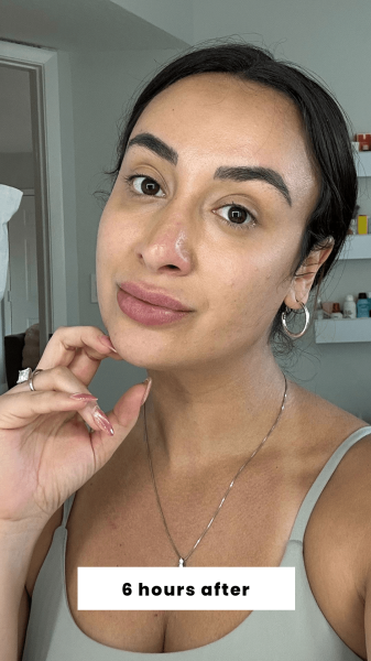 Trakoshis 6 hours after applying Benetint's Cheek  Lip Stain